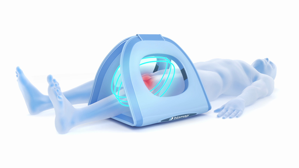 Qué es la magnetoterapia con tecnología 3D